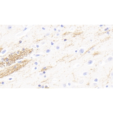 2',3'-Cyclic Nucleotide 3'-Phosphodiesterase (CNP) Human Polyclonal Antibody
