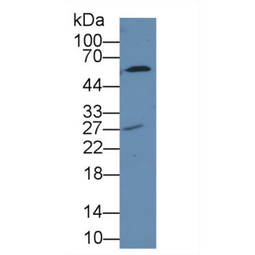 7-Dehydrocholesterol Reductase (DHCR7) Human Polyclonal Antibody
