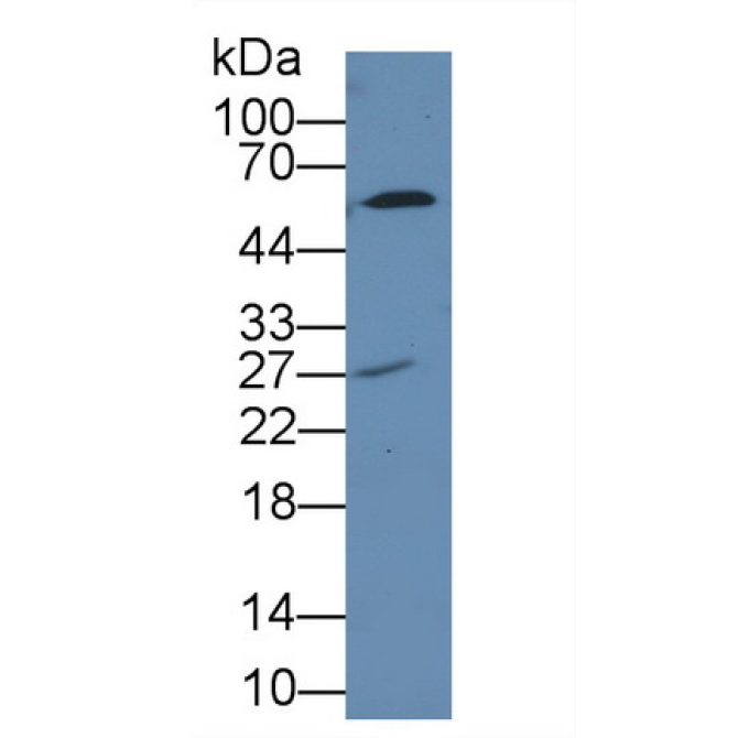 7-Dehydrocholesterol Reductase (DHCR7) Human Polyclonal Antibody