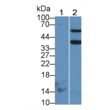 Aminoadipate Semialdehyde Phosphopantetheinyl Transferase (AASDHPPT) Human Polyclonal Antibody