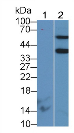 Aminoadipate Semialdehyde Phosphopantetheinyl Transferase (AASDHPPT) Human Polyclonal Antibody