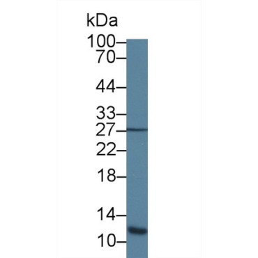 Acylphosphatase 1, Erythrocyte (ACYP1) Human Polyclonal Antibody