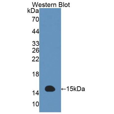Acylphosphatase 2 (ACYP2) Human Polyclonal Antibody