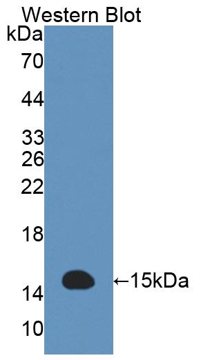 Acylphosphatase 2 (ACYP2) Human Polyclonal Antibody