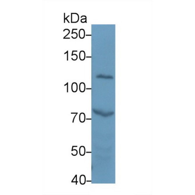 Alpha Adducin (ADD1) Human Polyclonal Antibody