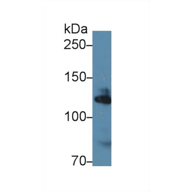 Alpha Adducin (ADD1) Mouse Polyclonal Antibody