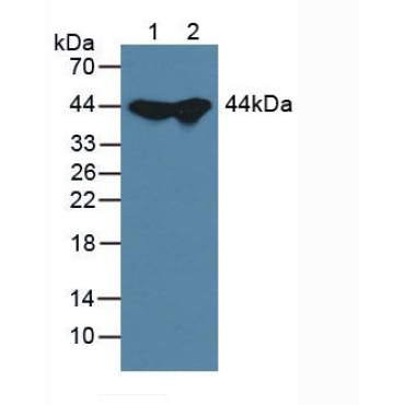Adenosine Kinase (ADK) Mouse Polyclonal Antibody