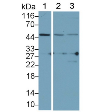 Adhesion Regulating Molecule 1 (ADRM1) Human Polyclonal Antibody