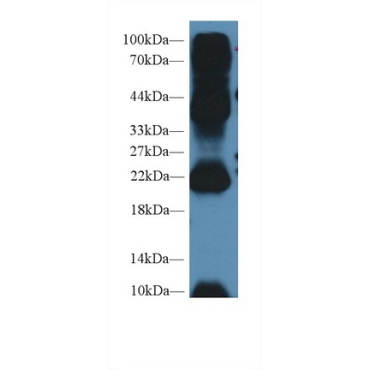 Anterior Gradient 2 (AGR2) Human Polyclonal Antibody