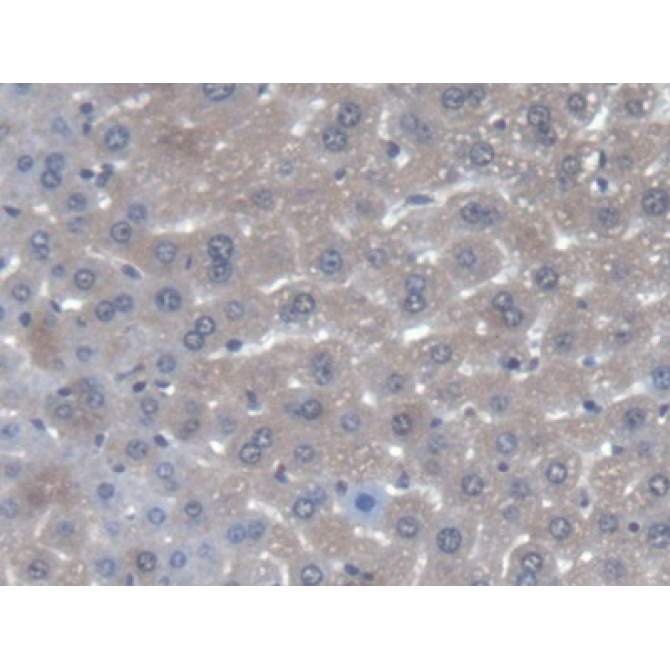 Alanine Glyoxylate Aminotransferase (AGXT) Mouse Polyclonal Antibody