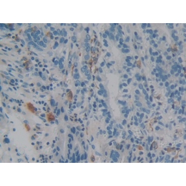Ionized Calcium-binding Adapter Molecule 1 (IBA1) Human Polyclonal Antibody