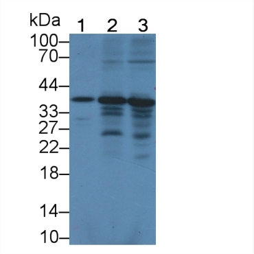 Aryl Hydrocarbon Receptor Interacting Protein (AIP) Human Polyclonal Antibody