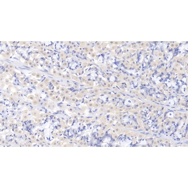 Aminolevulinate Delta Dehydratase (ALAD) Human Polyclonal Antibody