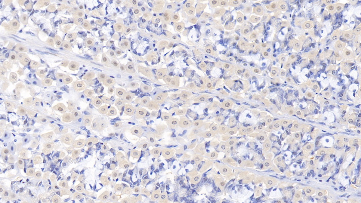 Aminolevulinate Delta Dehydratase (ALAD) Human Polyclonal Antibody