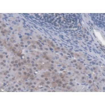 Autocrine Motility Factor Receptor (AMFR) Mouse Polyclonal Antibody