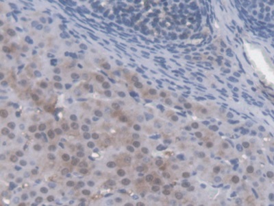 Autocrine Motility Factor Receptor (AMFR) Mouse Polyclonal Antibody