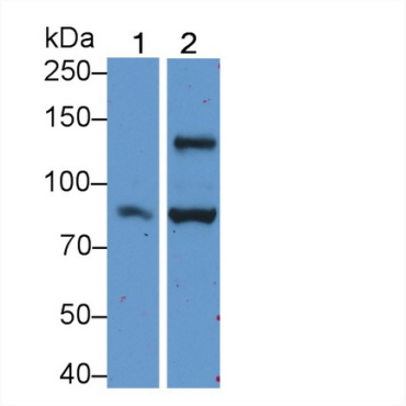 Angiomotin (AMOT) Human Polyclonal Antibody