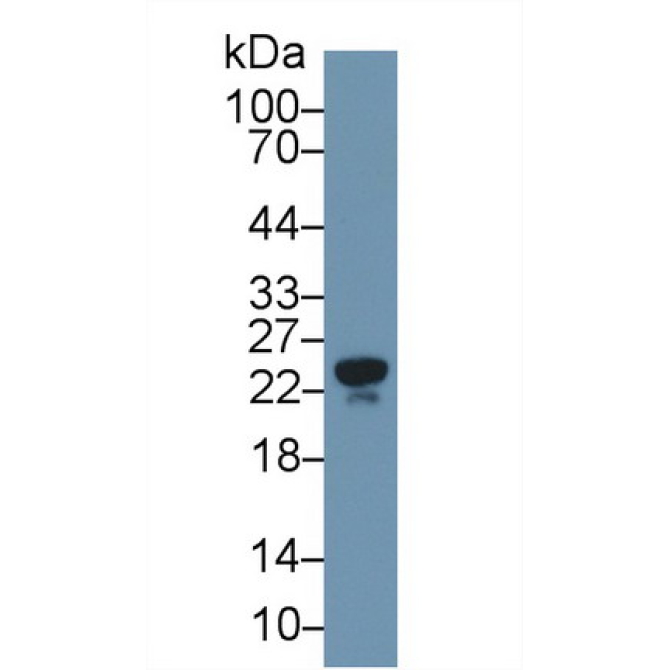 Apolipoprotein M (APOM) Human Polyclonal Antibody