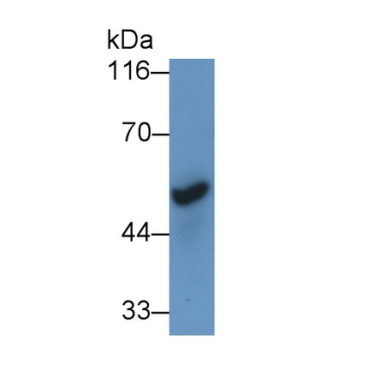 Cholinergic Receptor, Nicotinic, Alpha 7 (CHRNa7) Human Polyclonal Antibody