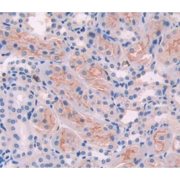 Ancient Ubiquitous Protein 1 (AUP1) Mouse Polyclonal Antibody