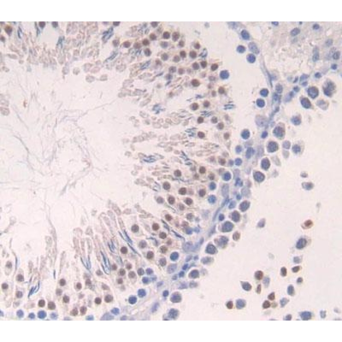 Aurora Kinase C (AURKC) Human Polyclonal Antibody