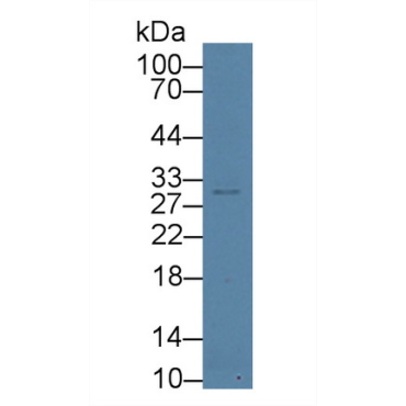 Aurora Kinase C (AURKC) Mouse Polyclonal Antibody