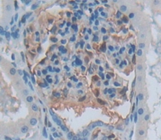 Aurora Kinase C (AURKC) Rat Polyclonal Antibody