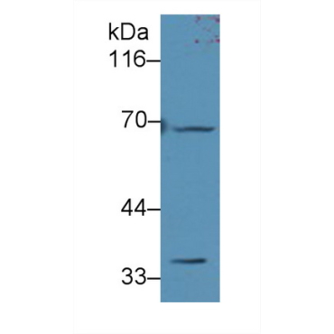 Adenine Phosphoribosyltransferase (APRT) Human Polyclonal Antibody