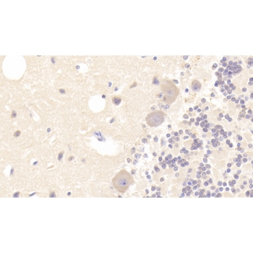 Tubulin Alpha 3C (TUBa3C) Human Polyclonal Antibody