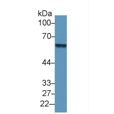 Antithrombin (AT) Human Polyclonal Antibody