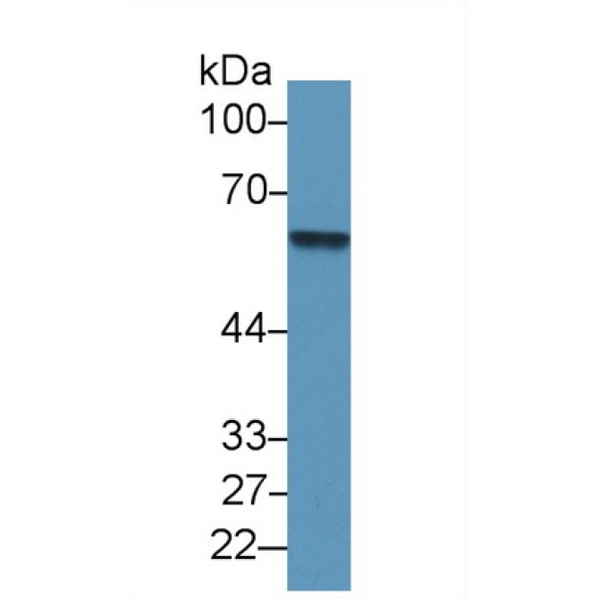 Antithrombin (AT) Human Polyclonal Antibody