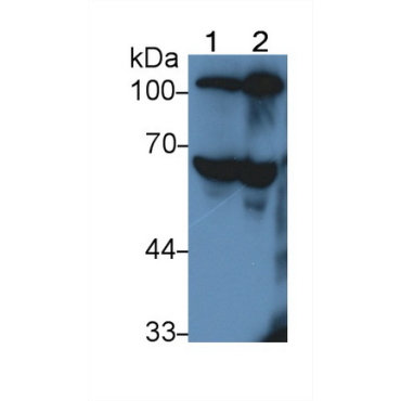 Antithrombin (AT) Human Polyclonal Antibody