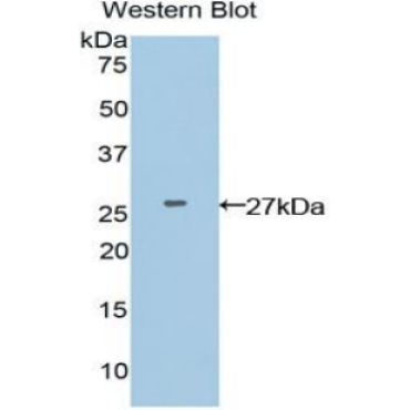 Adenomatosis Polyposis Coli Protein (APC) Human Polyclonal Antibody