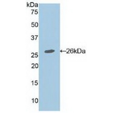 Adenomatosis Polyposis Coli Protein (APC) Mouse Polyclonal Antibody