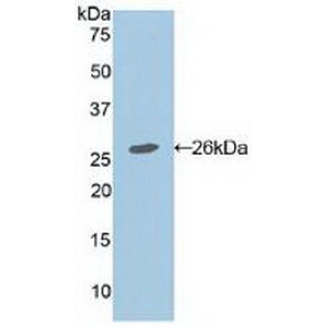Adenomatosis Polyposis Coli Protein (APC) Mouse Polyclonal Antibody