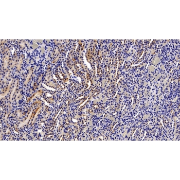 Argininosuccinate Synthetase 1 (ASS1) Human Polyclonal Antibody