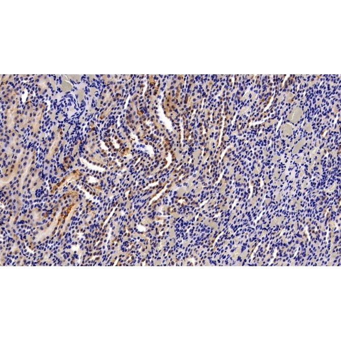 Argininosuccinate Synthetase 1 (ASS1) Human Polyclonal Antibody