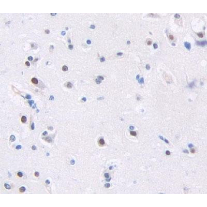 Aristaless Related Homeobox Protein (ARX) Human Polyclonal Antibody