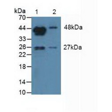 Aromatase (ARO) Human Polyclonal Antibody