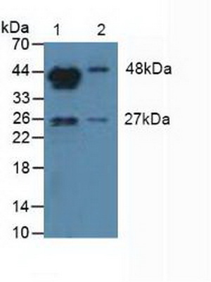 Aromatase (ARO) Human Polyclonal Antibody