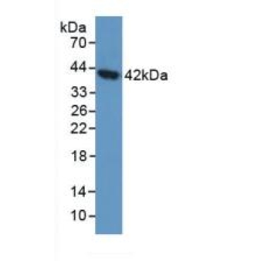 Aspartylglucosaminidase (AGA) Human Polyclonal Antibody