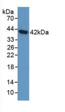 Aspartylglucosaminidase (AGA) Human Polyclonal Antibody