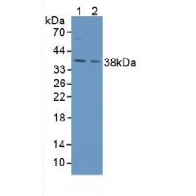 Aspartylglucosaminidase (AGA) Mouse Polyclonal Antibody