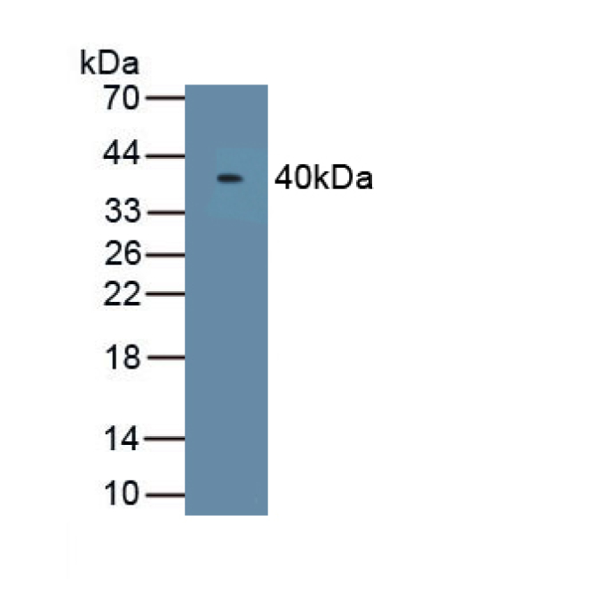 Asporin (ASPN) Human Polyclonal Antibody