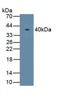 Asporin (ASPN) Human Polyclonal Antibody
