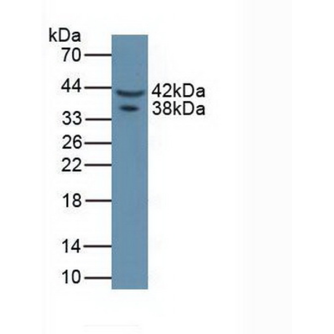 Asporin (ASPN) Mouse Polyclonal Antibody