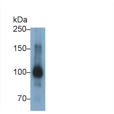Ectonucleotide Pyrophosphatase/Phosphodiesterase 2 (ENPP2) Human Polyclonal Antibody