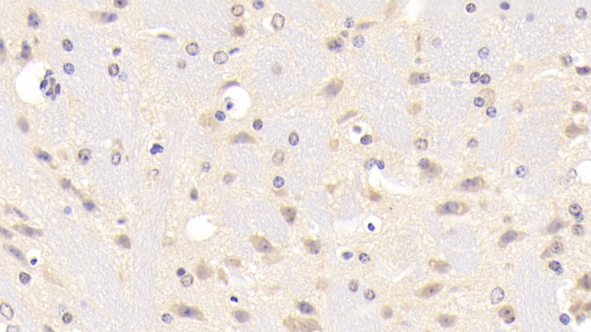 B-Cell CLL/Lymphoma 10 (Bcl10) Mouse Polyclonal Antibody