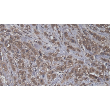 Bcl6 Corepressor (BCOR) Human Polyclonal Antibody