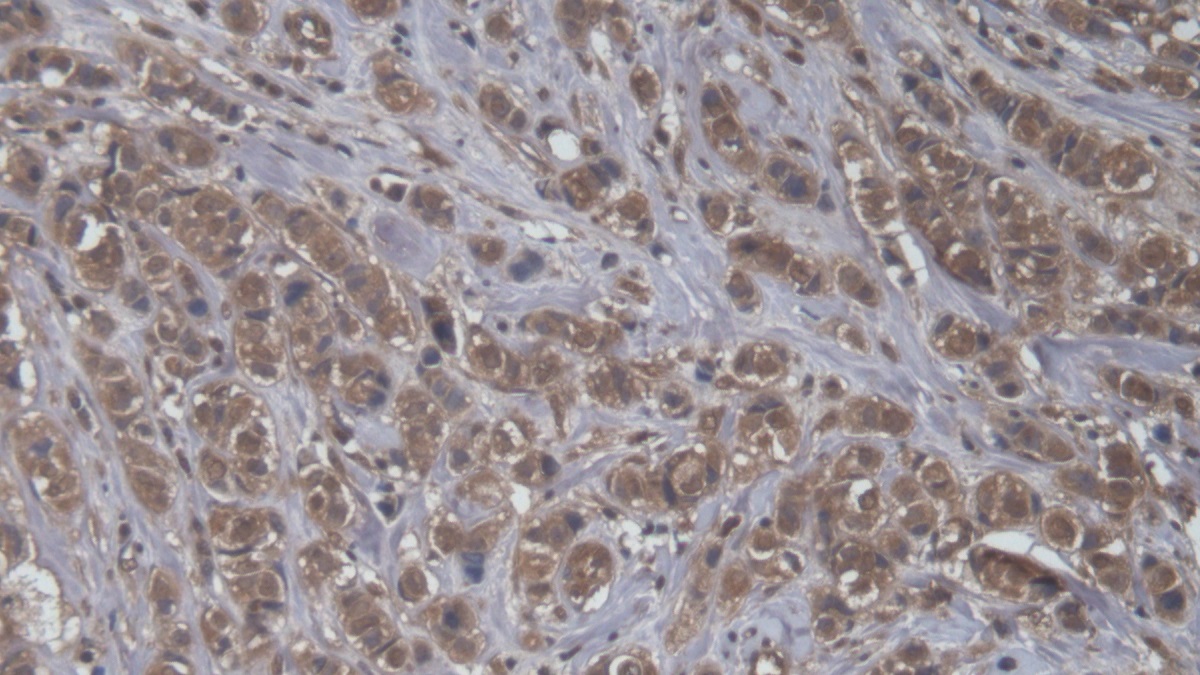 Bcl6 Corepressor (BCOR) Human Polyclonal Antibody
